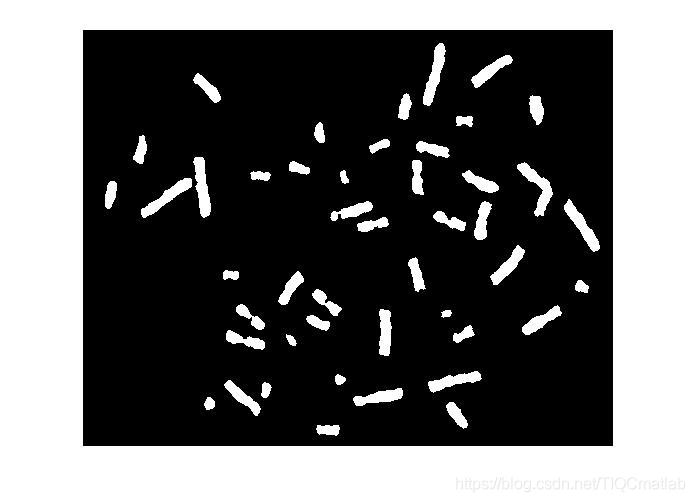 【染色体识别】基于matlab形态学染色体计数【含Matlab源码 1066期】_matlab_20