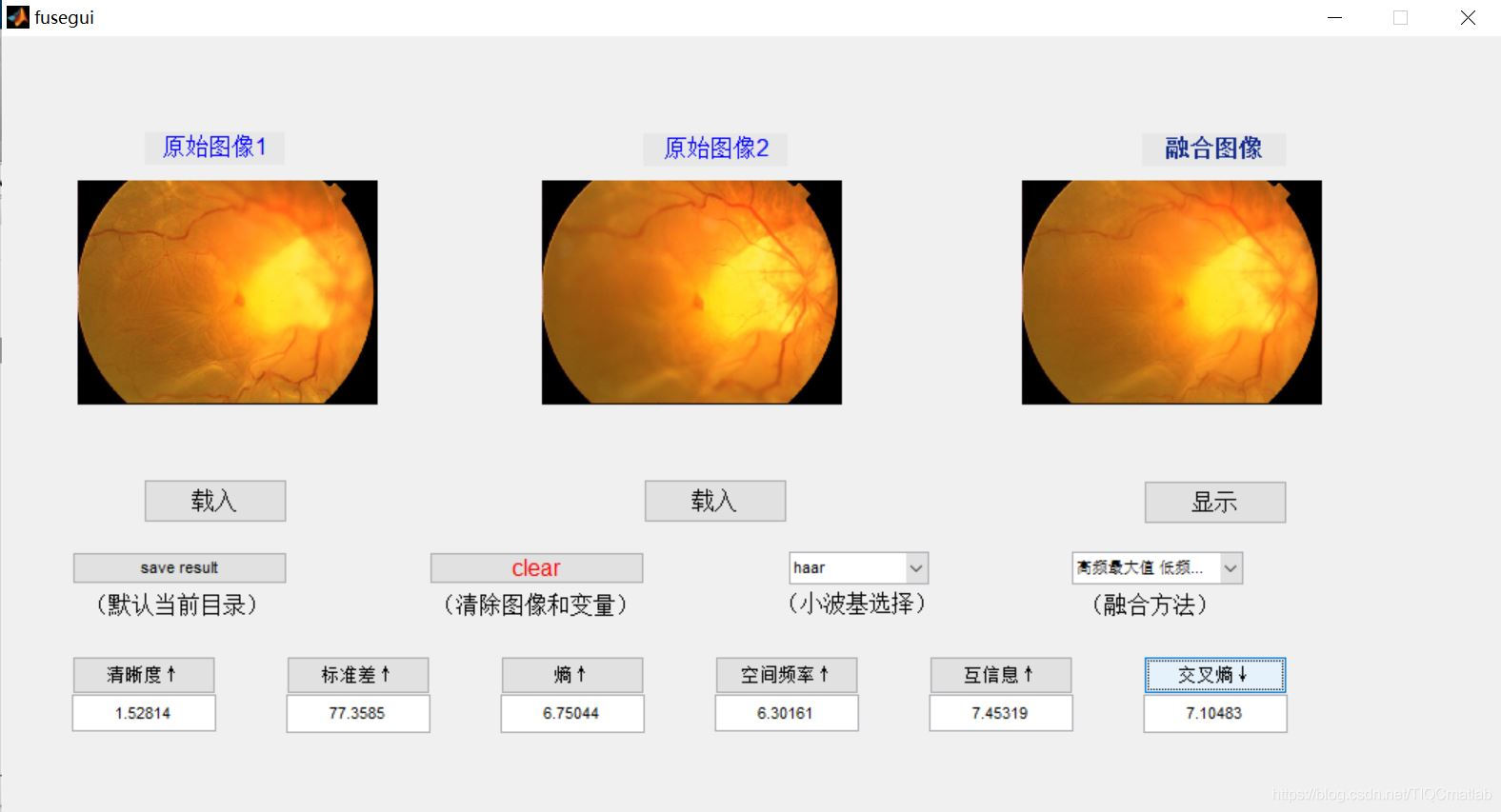 【图像融合】基于matlab GUI区域分割图像融合（融合指标）【含Matlab源码 866期】_图像融合