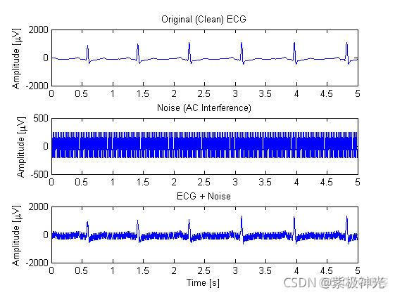 【心电信号】基于matlab瞬时抑制心电信号IIR滤波【含Matlab源码 1533期】_小波变换_03