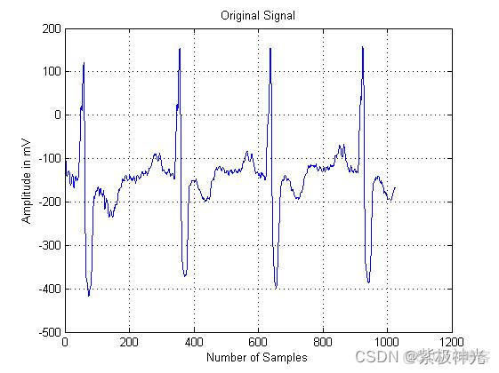 【脑电信号】基于matlab小波变换DWT脑电信号ECG去噪【含Matlab源码 1622期】_小波基_04