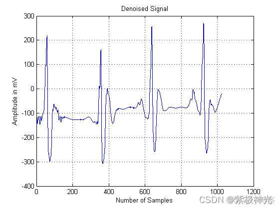 【脑电信号】基于matlab小波变换DWT脑电信号ECG去噪【含Matlab源码 1622期】_开发语言_05