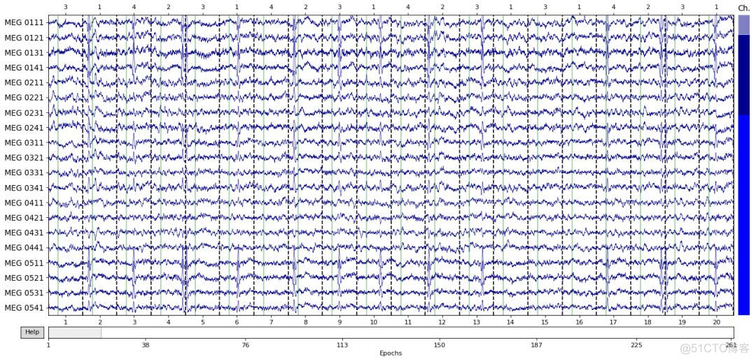 脑电数据的Epoching处理_列表_06