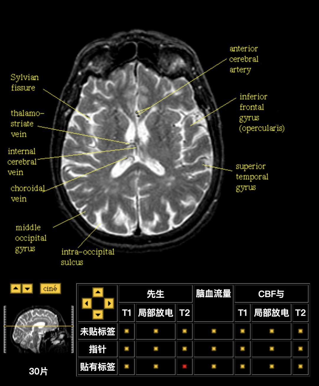 经典大脑解剖网站大全_脑科学_03