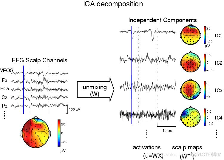 ICA独立成分分析去除EEG伪影_数据_02