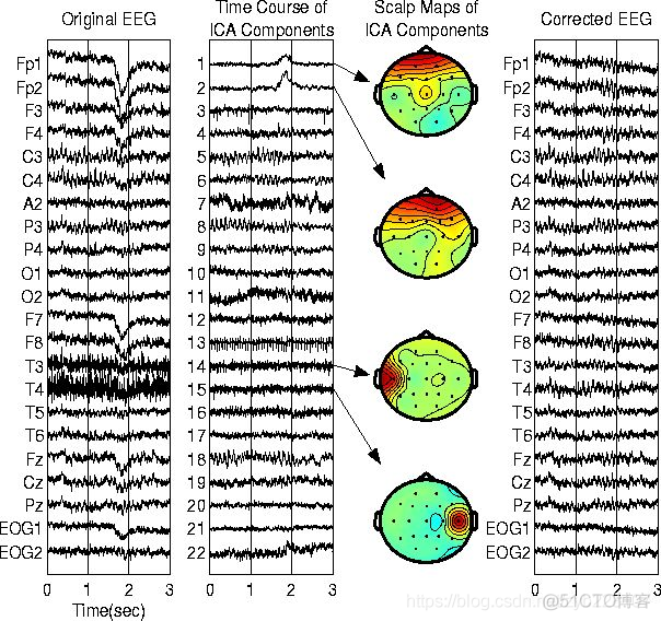 ICA独立成分分析去除EEG伪影_伪像_04