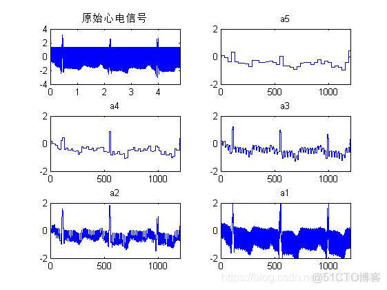 【心电信号】基于matlab小波变换心电信号去噪【含Matlab源码 956期】_小波变换_15