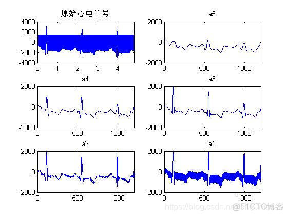【心电信号】基于matlab小波变换心电信号去噪【含Matlab源码 956期】_小波基_16