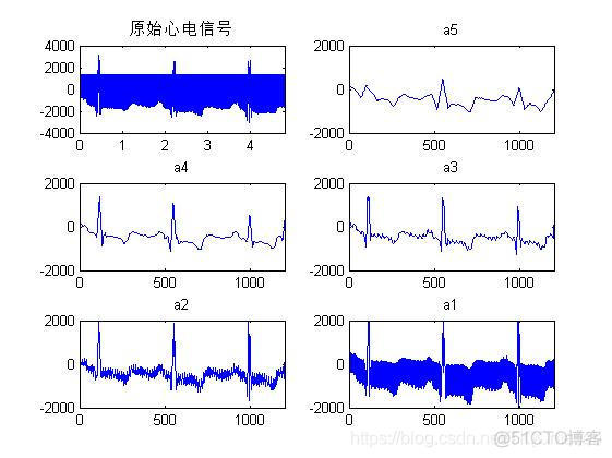 【心电信号】基于matlab小波变换心电信号去噪【含Matlab源码 956期】_去噪_17