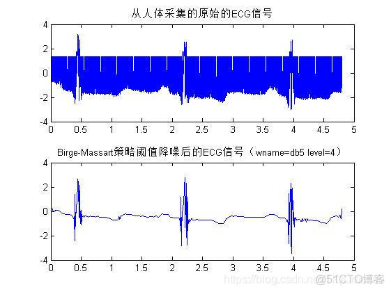 【心电信号】基于matlab小波变换心电信号去噪【含Matlab源码 956期】_去噪_18