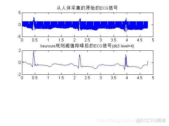 【心电信号】基于matlab小波变换心电信号去噪【含Matlab源码 956期】_小波基_19