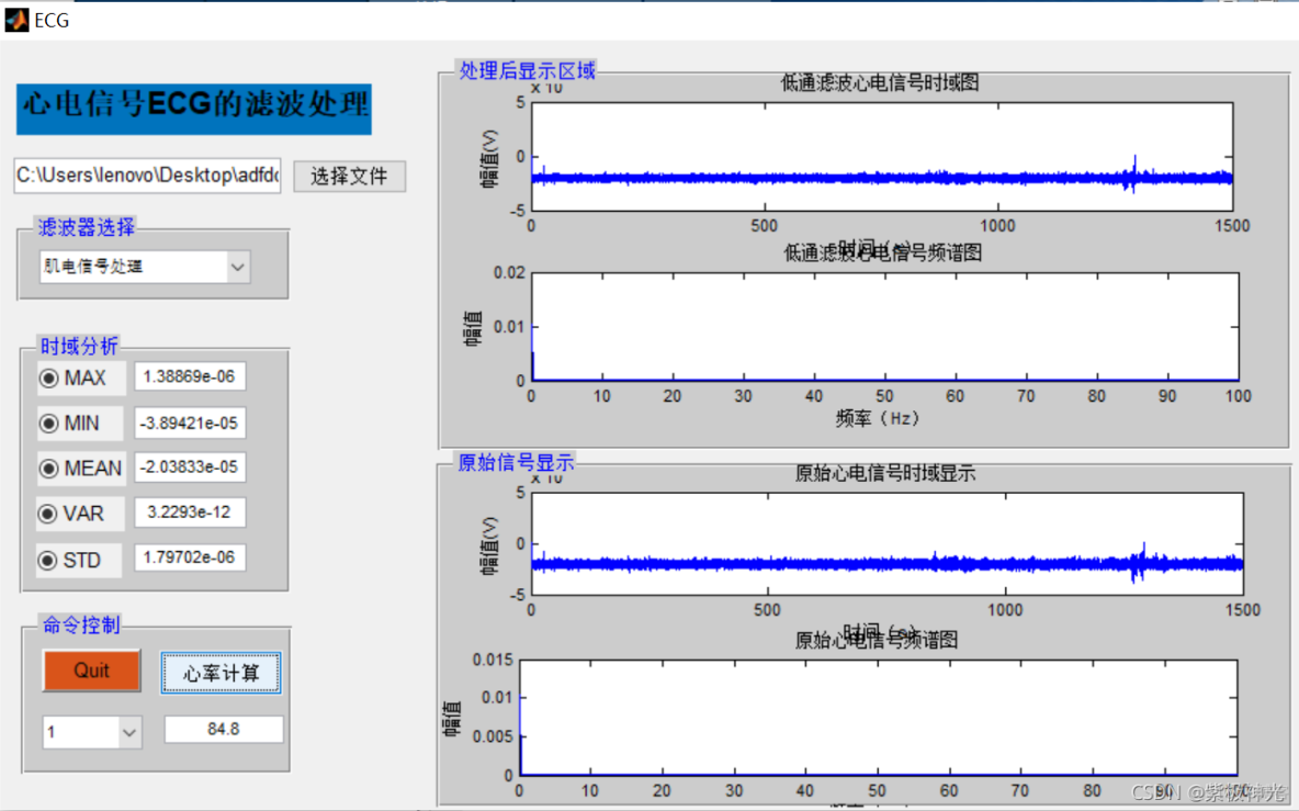 【心电信号】基于matlab GUI心电信号数字滤波处理【含Matlab源码 484期】_ide_02