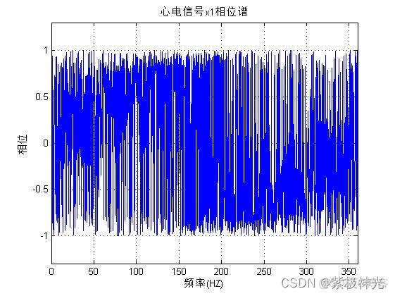 【心电信号】基于matlab心电信号特征提取+分析处理【含Matlab源码 289期】_维纳滤波_03