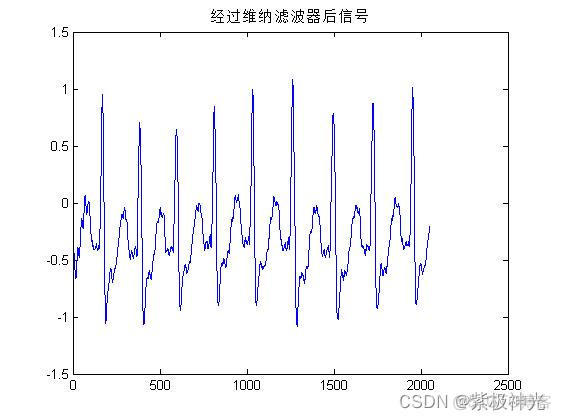 【心电信号】基于matlab心电信号特征提取+分析处理【含Matlab源码 289期】_算法_09