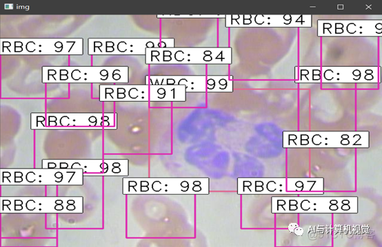 一文详解R-CNN、Fast R-CNN、Faster_tensorflow_20