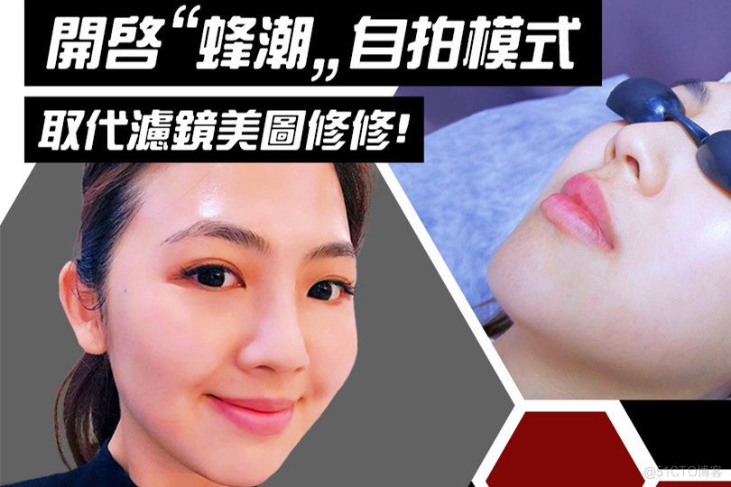 黑脸娃娃效果神奇功效打造女人不老传奇！_科斯杰调Q激光_03