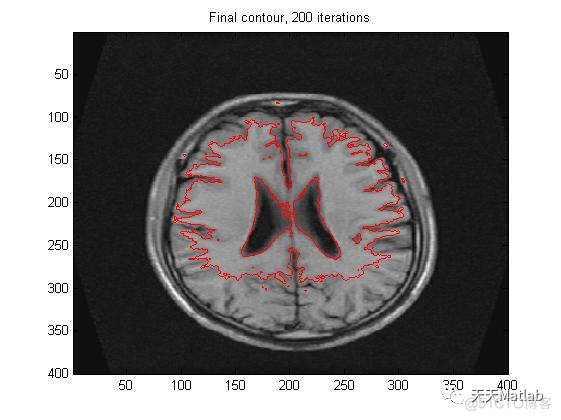 【图像分割】基于 C-V模型水平集图像分割Matlab代码_图像分割_02