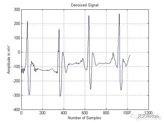 【脑电信号】小波变换DWT脑电信号ECG去噪matlab源码_小波变换_05