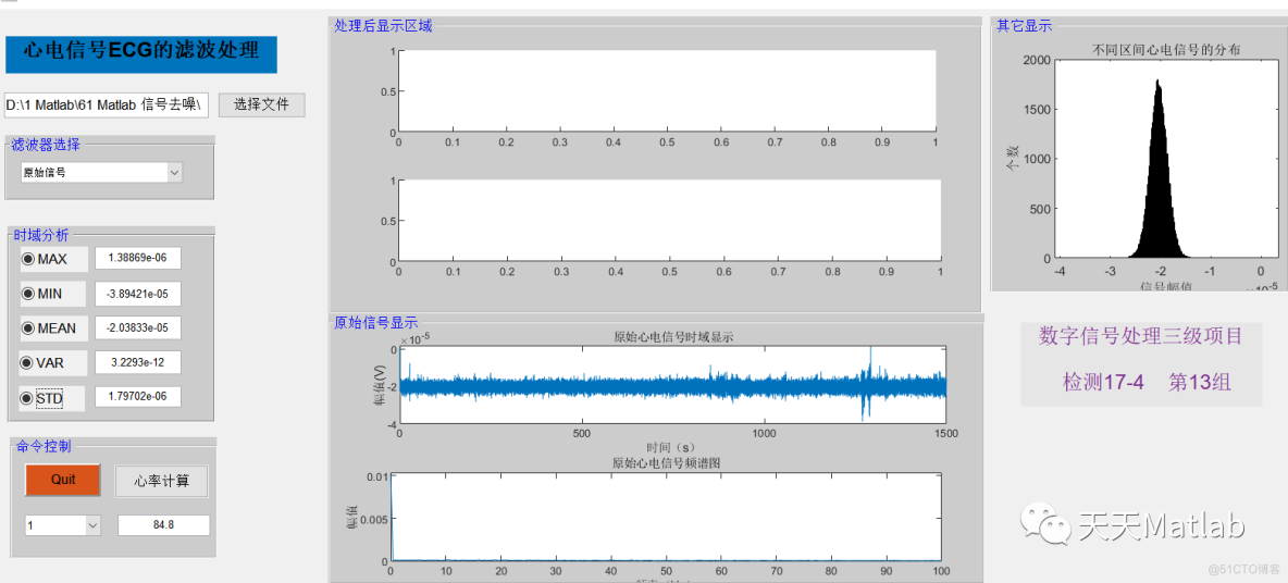【信号去噪】心电信号ECG滤波处理含Matlab源码_去噪
