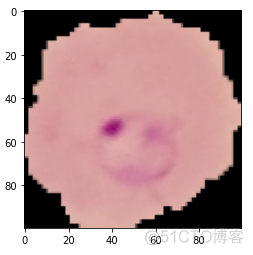 【深度学习】实战深度学习检测疟疾_python_03