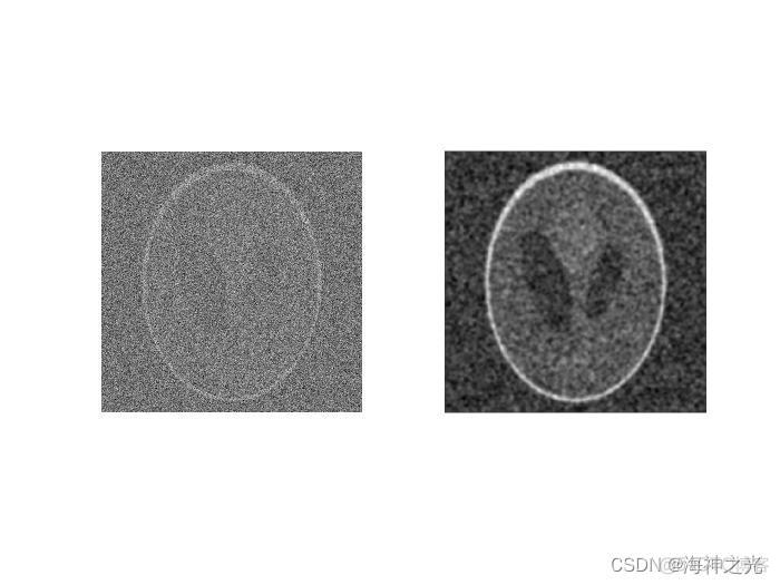 【图像去噪】基于matlab各向异性滤波图像去噪【含Matlab源码 1894期】_计算机视觉_05