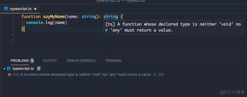 【Vuejs】301- Vue 3.0前的 TypeScript 最佳入门实践_typescript_14
