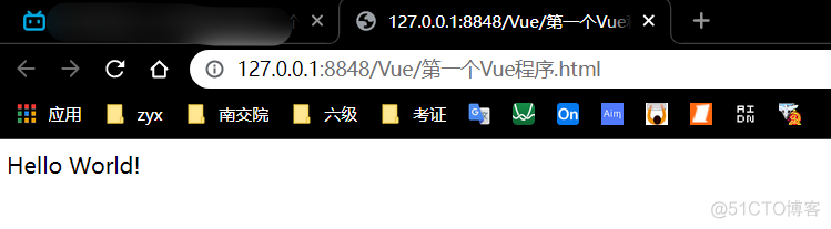 【Vue】基础入门学习_返回顶部_03