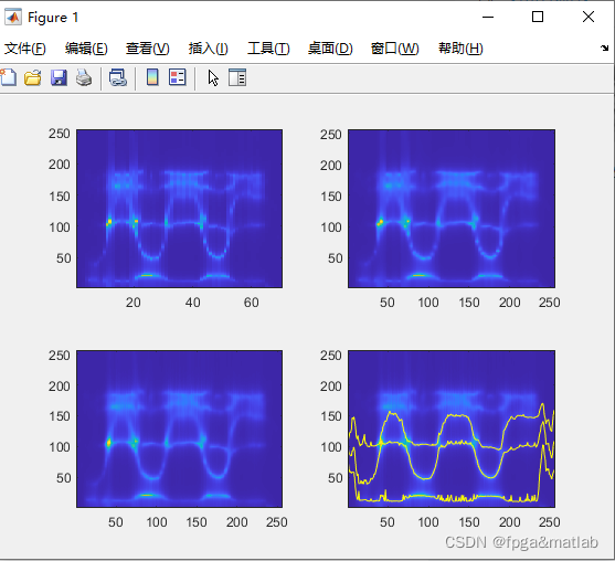 【共振峰跟踪】通过平均不同分辨率的方法跟踪共振峰，基于时频lpc的频谱图的MATLAB仿真_语音增强