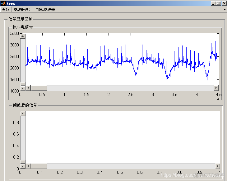 心电信号系统GUI系统_ECG_05