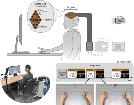 通过超高密度脑电记录系统实现单个手指运动精准解码_脑机接口_03