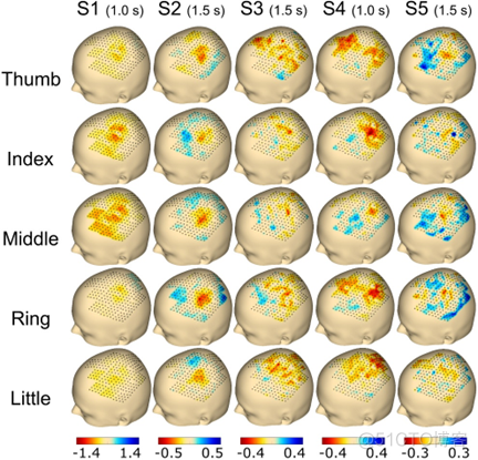 通过超高密度脑电记录系统实现单个手指运动精准解码_支持向量机_05
