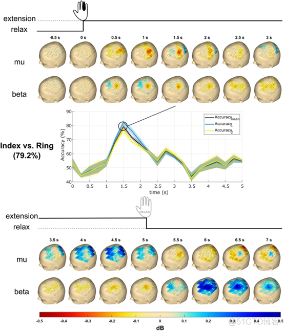 通过超高密度脑电记录系统实现单个手指运动精准解码_微信_06