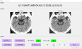 【图像分割】基于matlab GUI医学图像均值聚类+OUST+区域生长法图像分割【含Matlab源码 2210期】