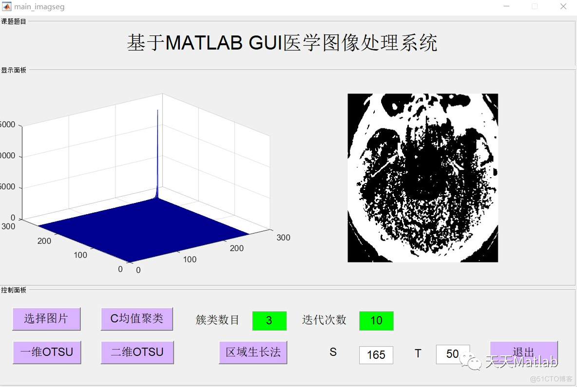 【图像分割】基于均值聚类+OUST+区域生长法实现MRI图像分割附matlab代码_选择图片_03