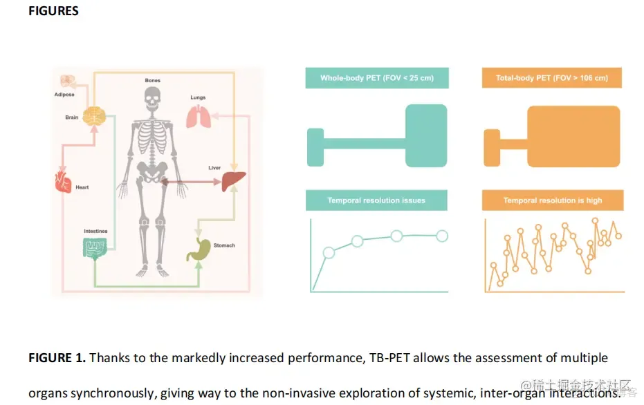 whole-body PET ？全人研究的催化剂？_算法