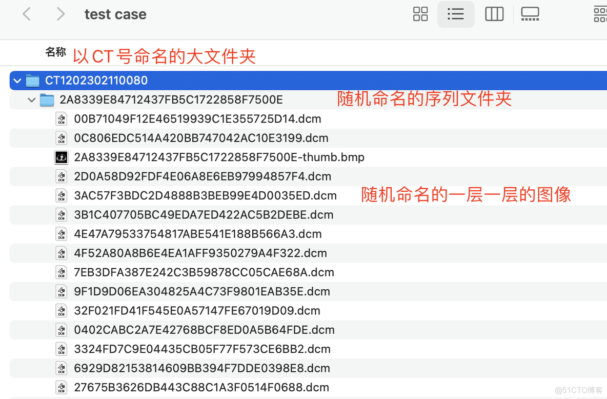 数据预处理--sort乱序DICOM文件_ico_02