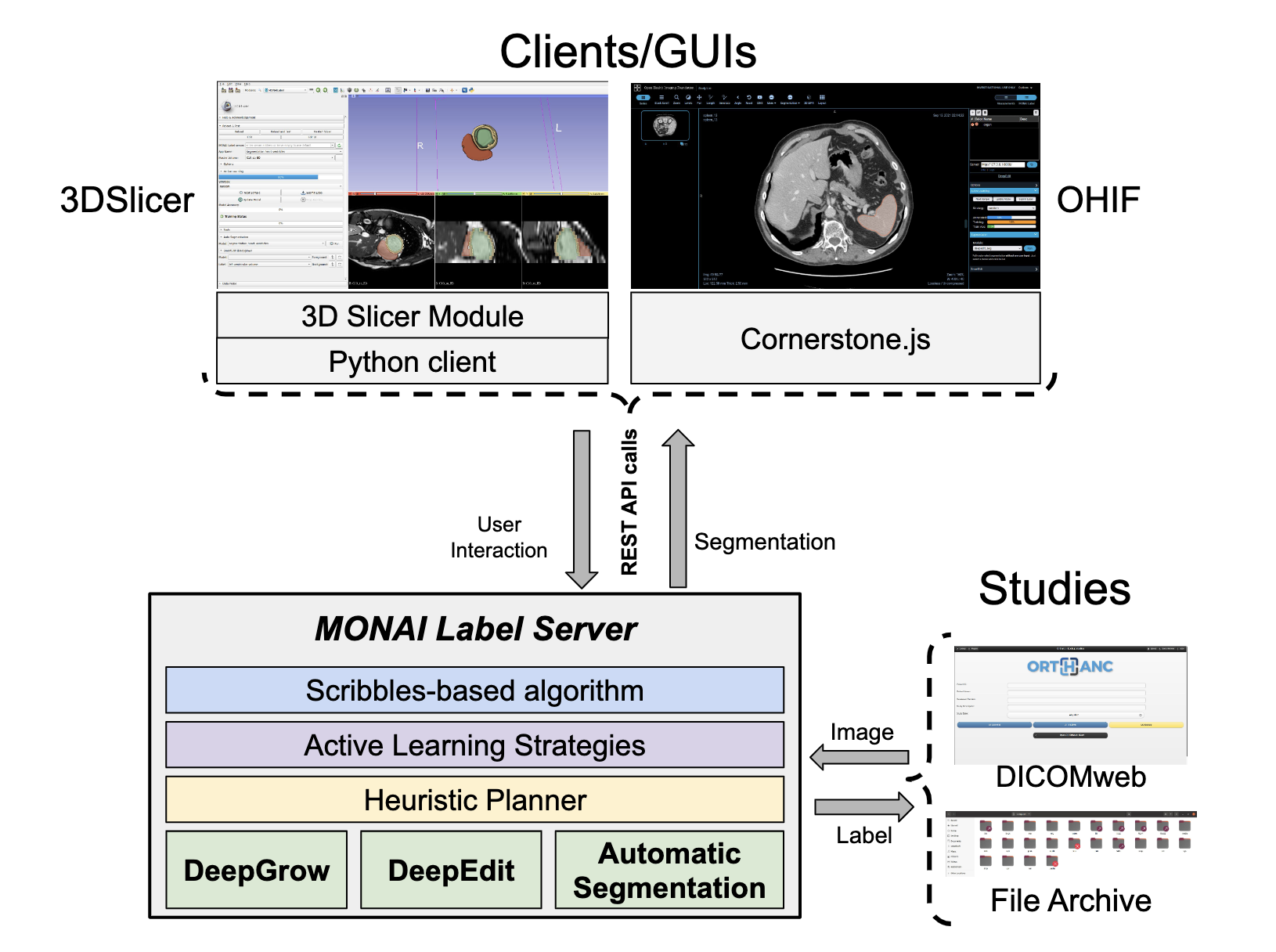 【论文阅读】MONAI Label：人工智能辅助的 3D 医学图像交互式标注框架_人工智能