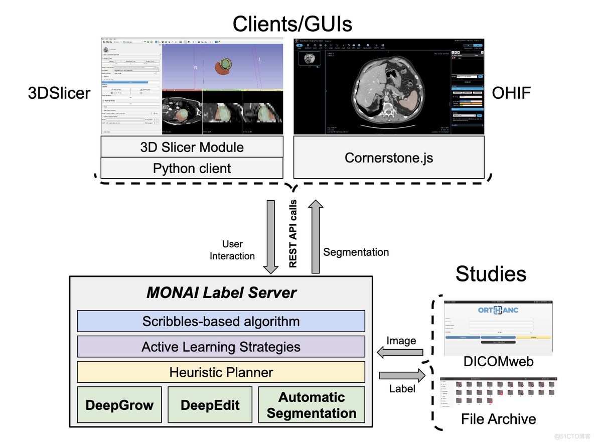 【论文阅读】MONAI Label：人工智能辅助的 3D 医学图像交互式标注框架_医学图像
