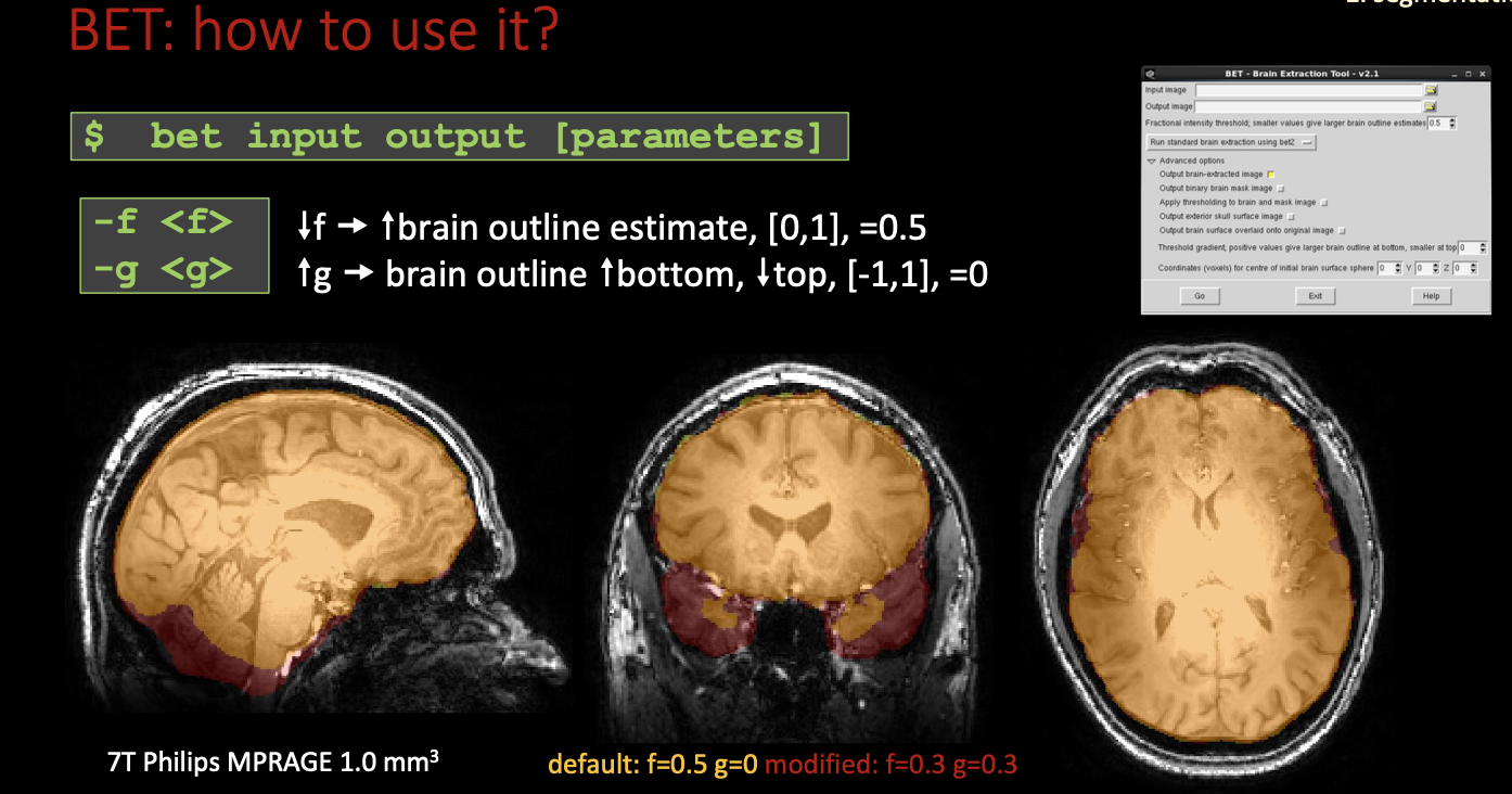 介绍一款 MRI&CT 图像预处理强大工具--FSL_3D_02
