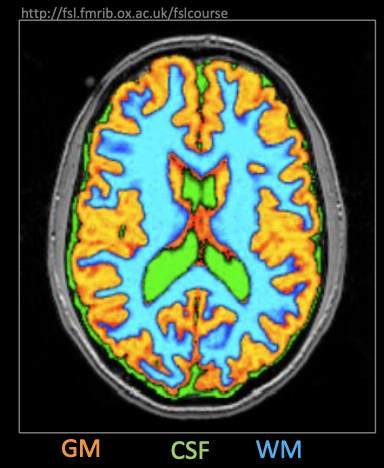 介绍一款 MRI&CT 图像预处理强大工具--FSL_3D_03