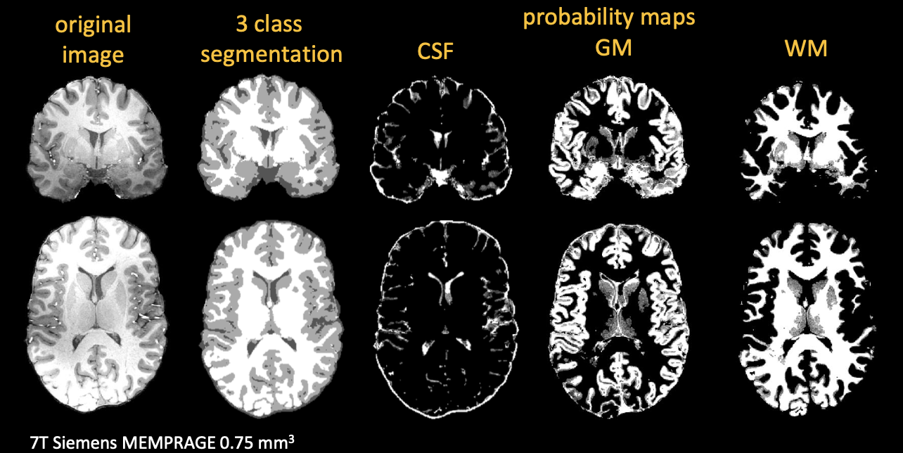 介绍一款 MRI&CT 图像预处理强大工具--FSL_sed_04
