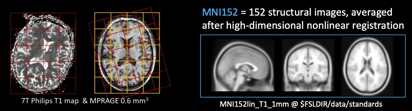 介绍一款 MRI&CT 图像预处理强大工具--FSL_数据_05