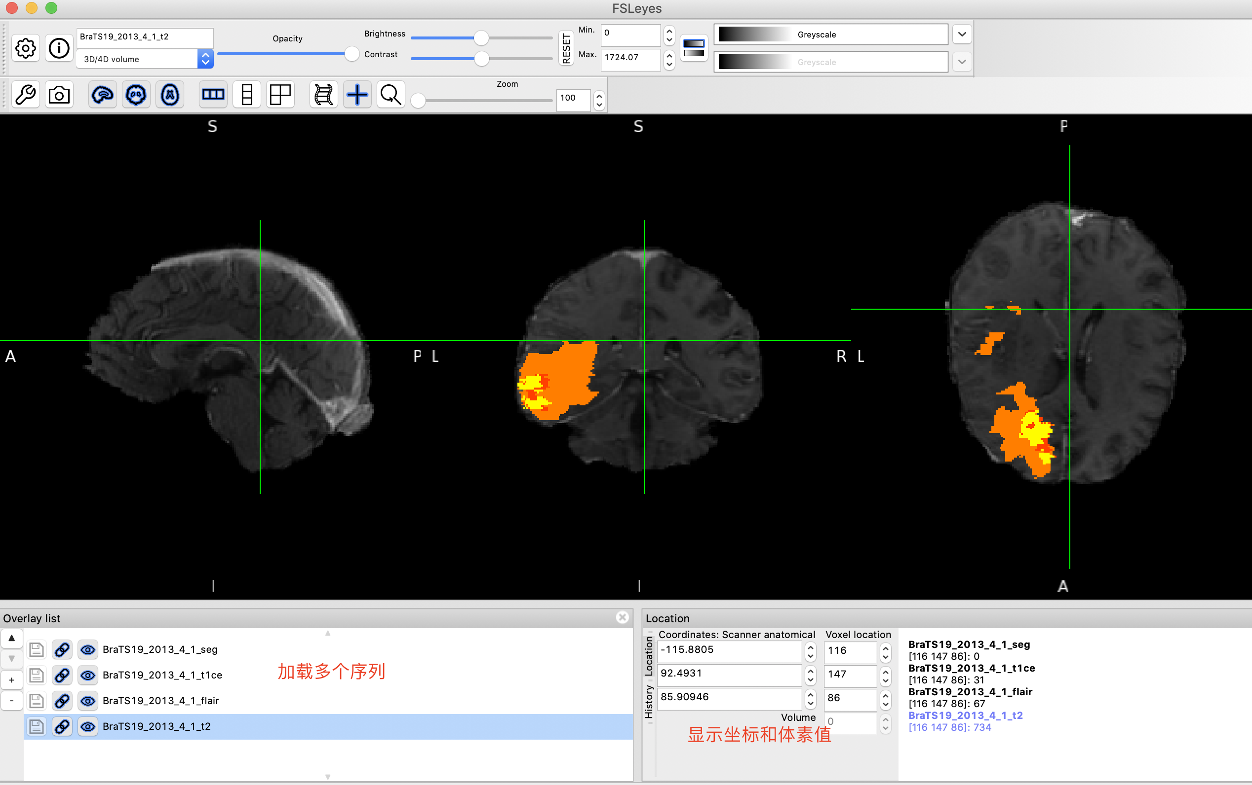 介绍一款 MRI&CT 图像预处理强大工具--FSL_FSL图像处理_06