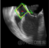 医学图像处理综述_图像配准_08