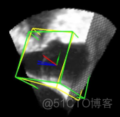 医学图像处理综述_图像处理_09