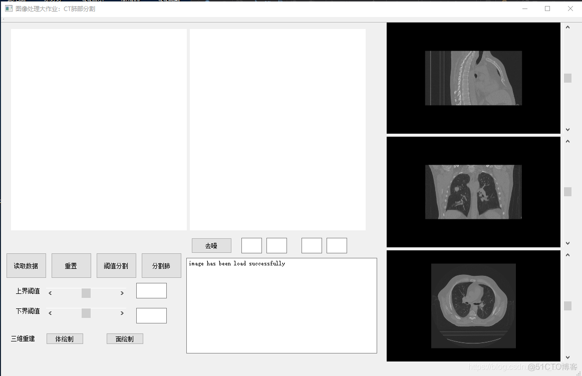 ct图像分割python ct图像分割及重建系统_ci_02