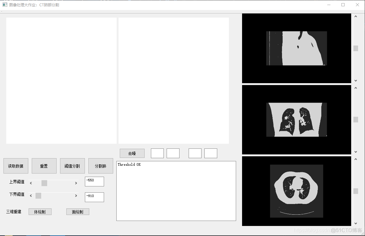 ct图像分割python ct图像分割及重建系统_ct图像分割python_03
