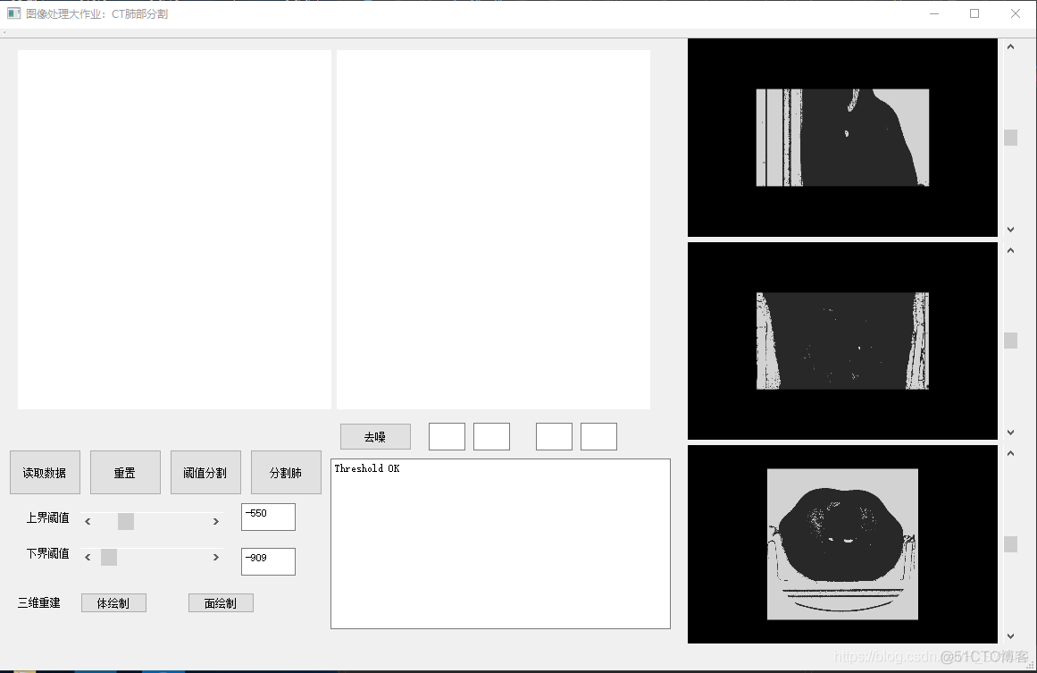 ct图像分割python ct图像分割及重建系统_ci_04