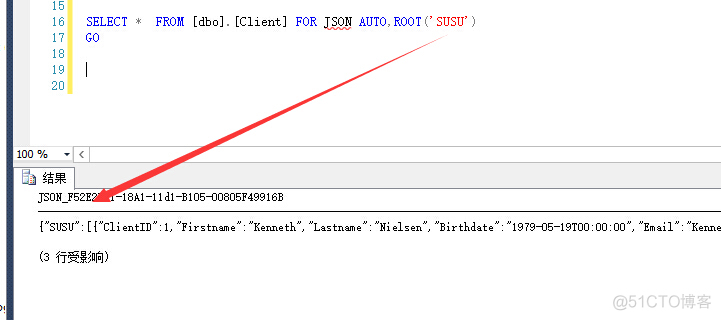 sql server json sql server json类型_Server_02