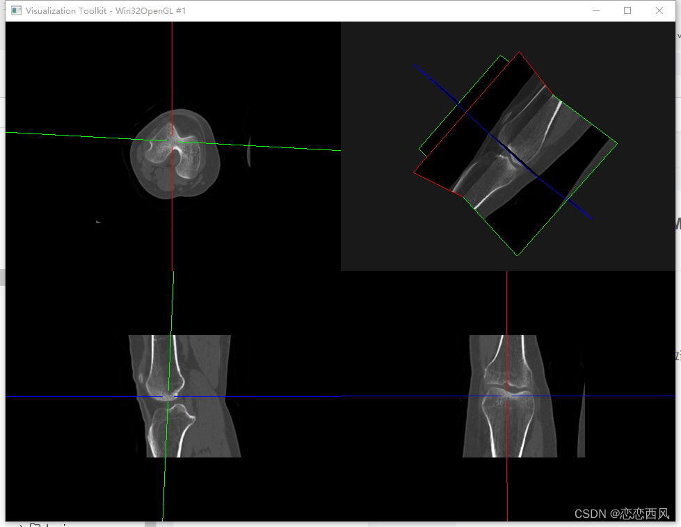 三维重建 PyQt Python MPR 四视图（横断面，冠状面，矢状面，3D）_pyqt