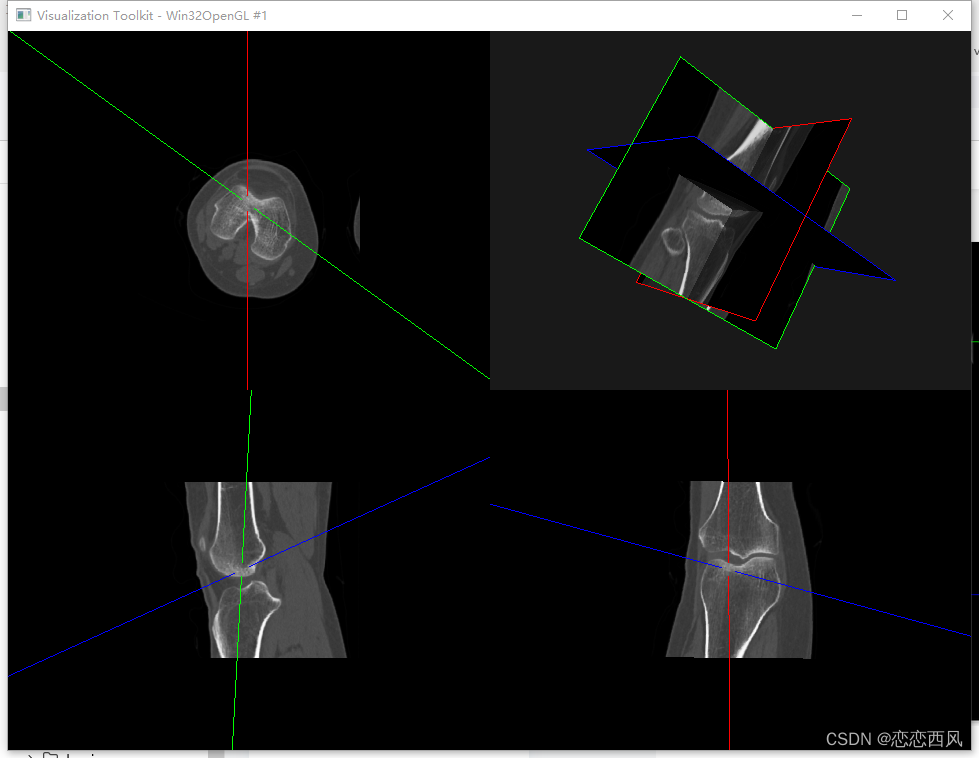 三维重建 PyQt Python MPR 四视图（横断面，冠状面，矢状面，3D）_pyqt_02